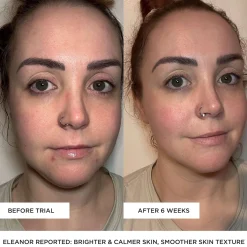 BeautyPro Tools & Accessories Photon Wand Best