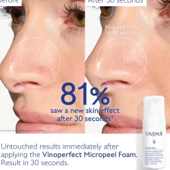 Caudalie Vinoperfect Brightening Daily AHA Micropeel 100ml Outlet