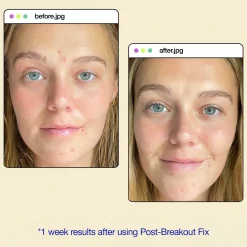 Dermalogica Clear Start™ Post-Breakout Fix 15ml Sale