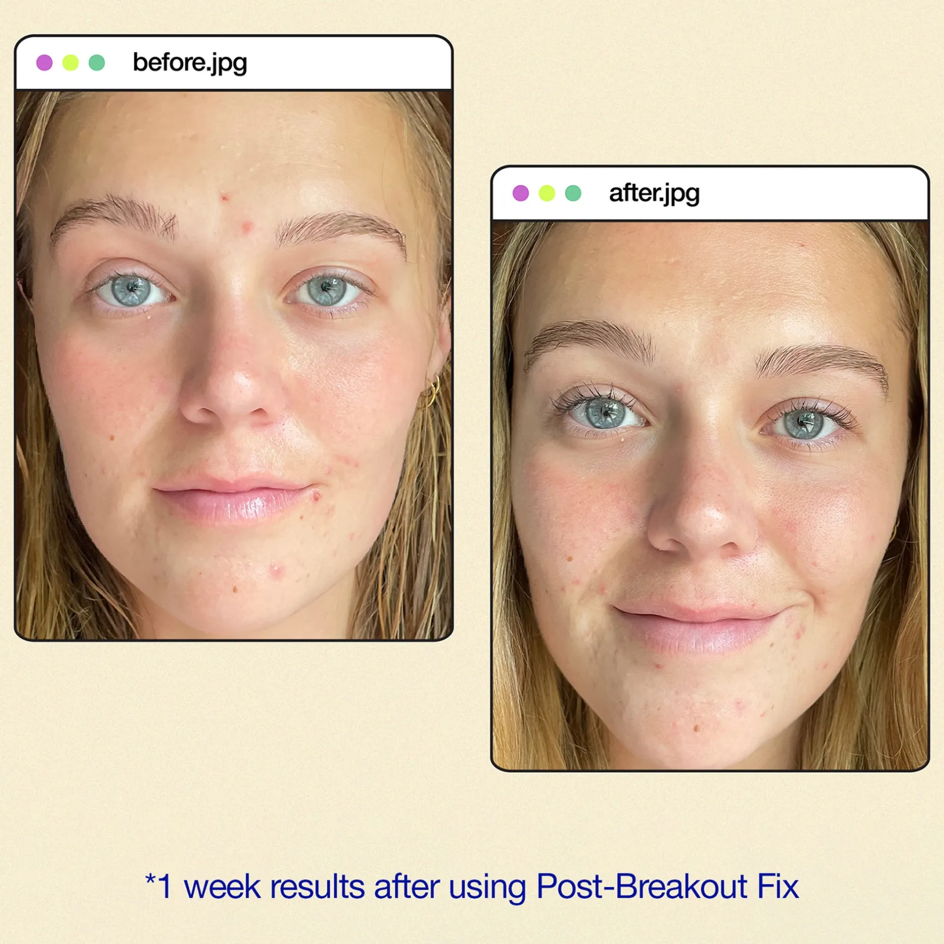 Dermalogica Clear Start™ Post-Breakout Fix 15ml Sale