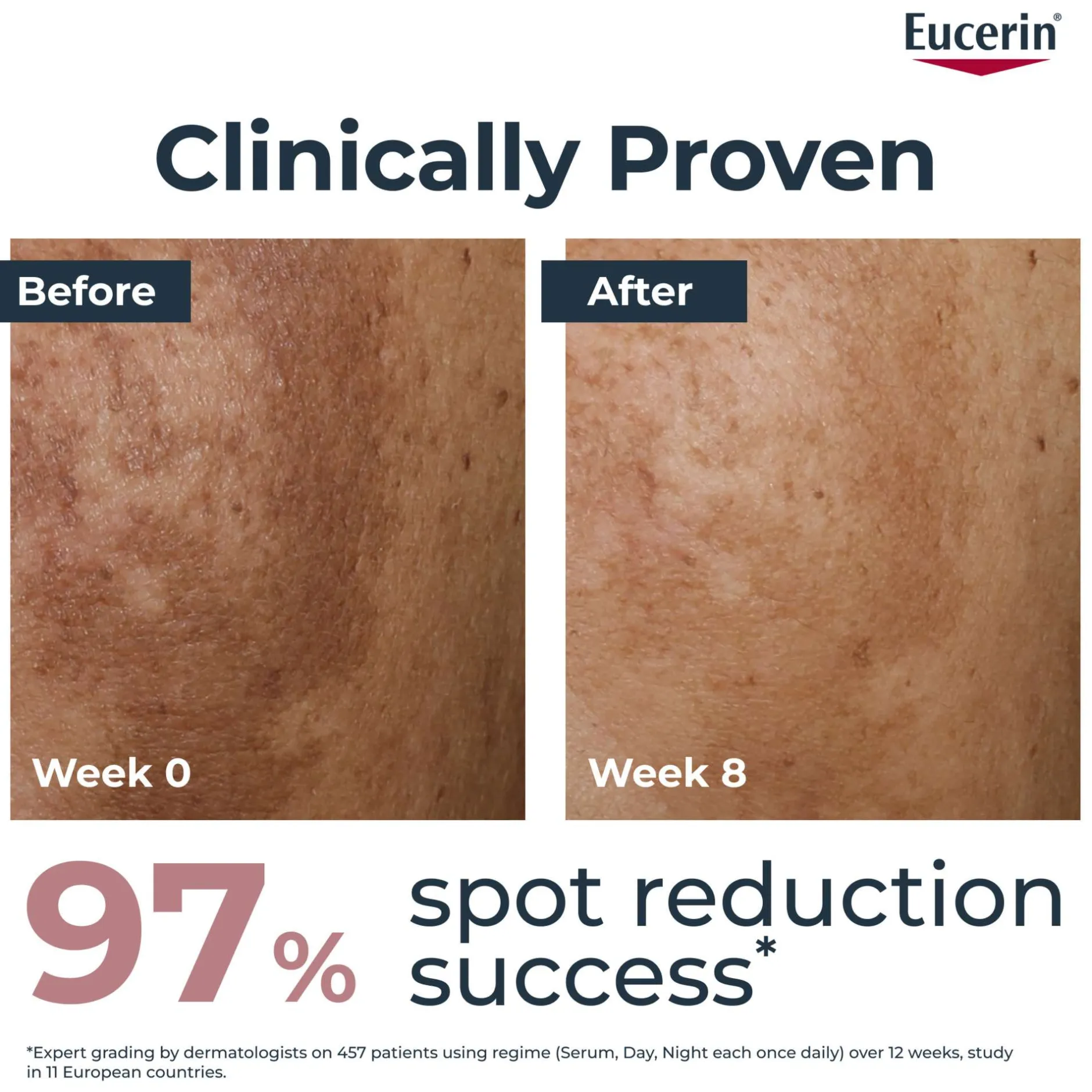 Eucerin Anti-Pigment Day Cream SPF30 50ml New