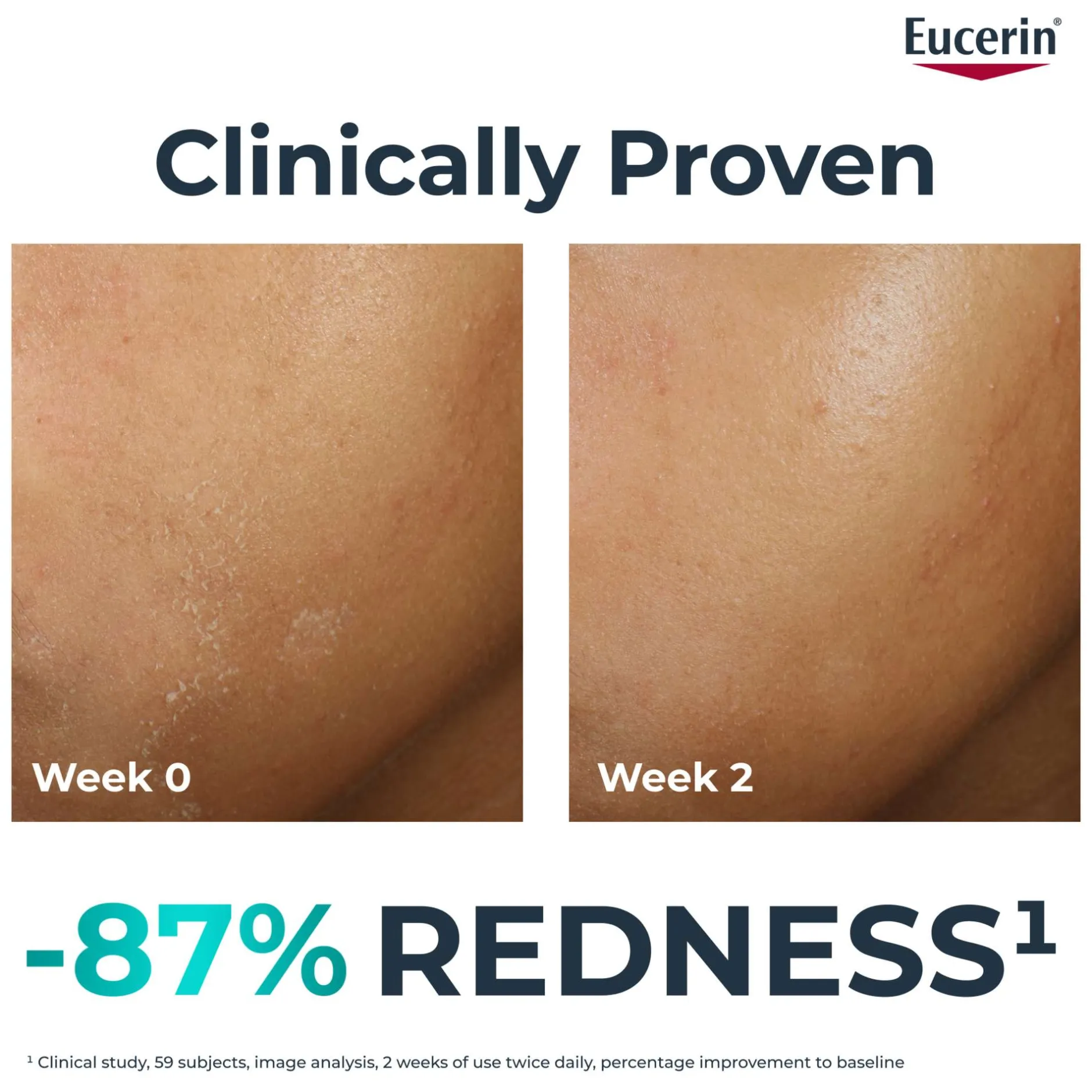 Eucerin DermoPure Clinical Hydra Repair Fluid 40ml Sale