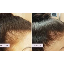 Hair Gain Gummies 1 Month Supply x 60 Gummies Best