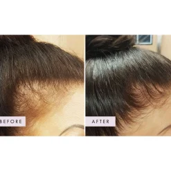 Hair Gain Gummies Duo - 2 Month Supply x 120 Gummies Hot