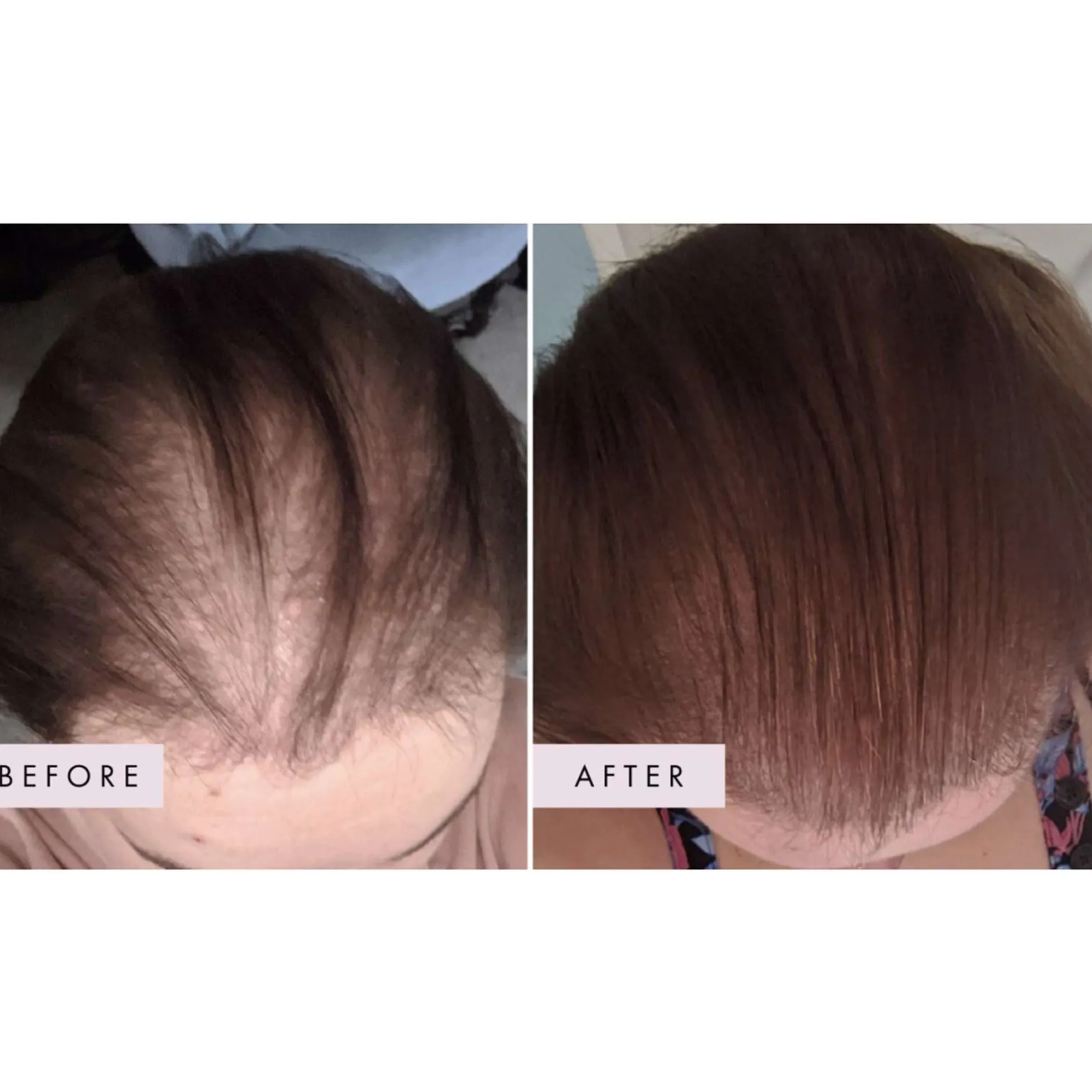 Hair Gain Hair Capsules Trio - 3 Month Supply x 180 Capsules Clearance
