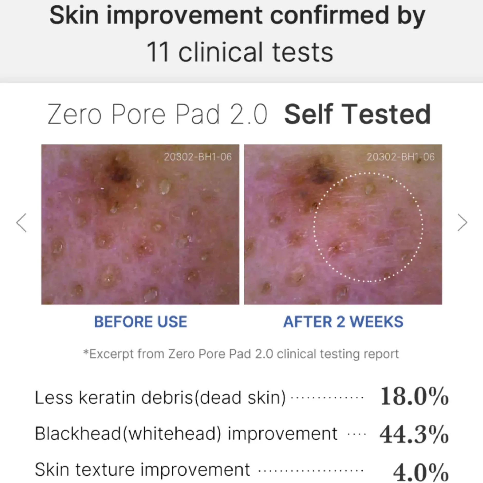 Medicube Skincare Zero Pore Pad 2.0 x 70 Sale