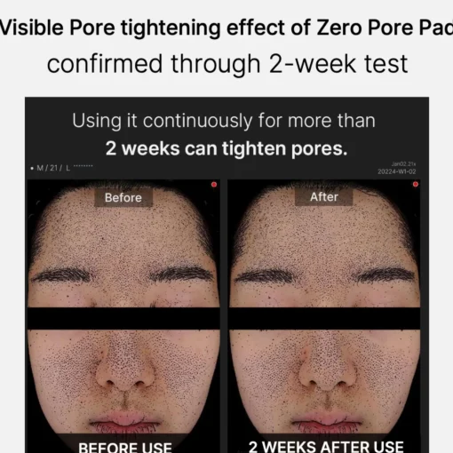 Medicube Skincare Zero Pore Pad 2.0 x 70 Sale