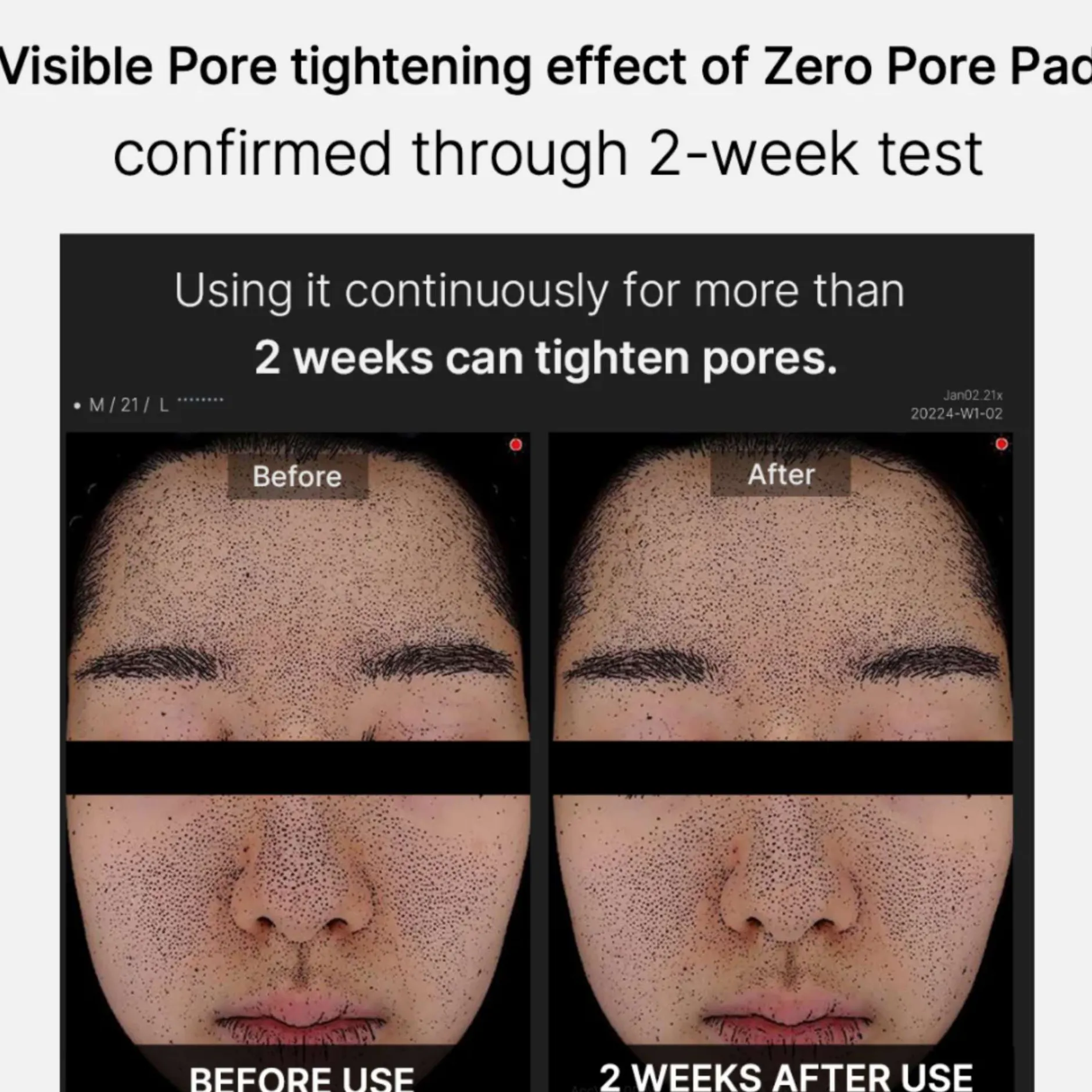 Medicube Skincare Zero Pore Pad 2.0 x 70 Sale