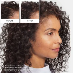 Nioxin Pro Clinical Anti-Hair Loss Anti Hair Loss Shampoo 240ml Sale