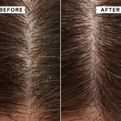 Philip Kingsley Masks Duo: Flaky/Itchy Scalp 2 x 20ml